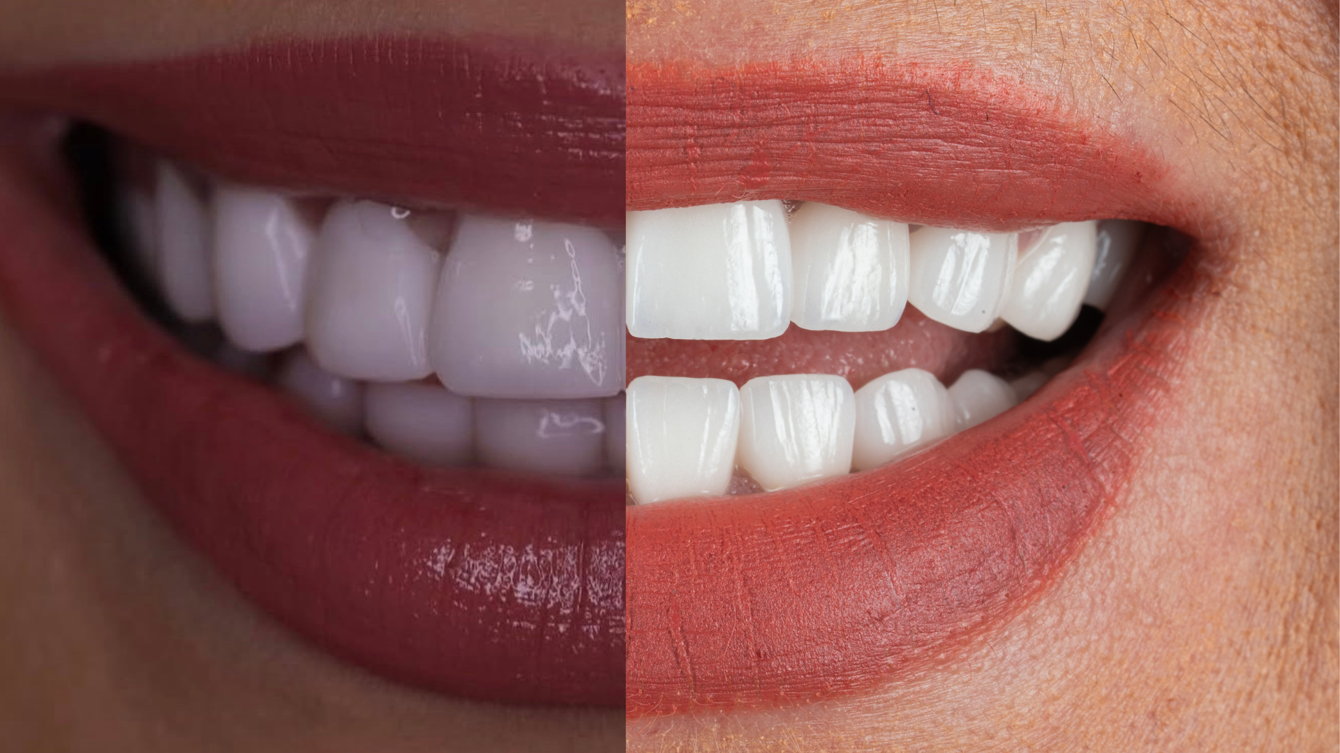 Before and after clinical case comparison, case 2